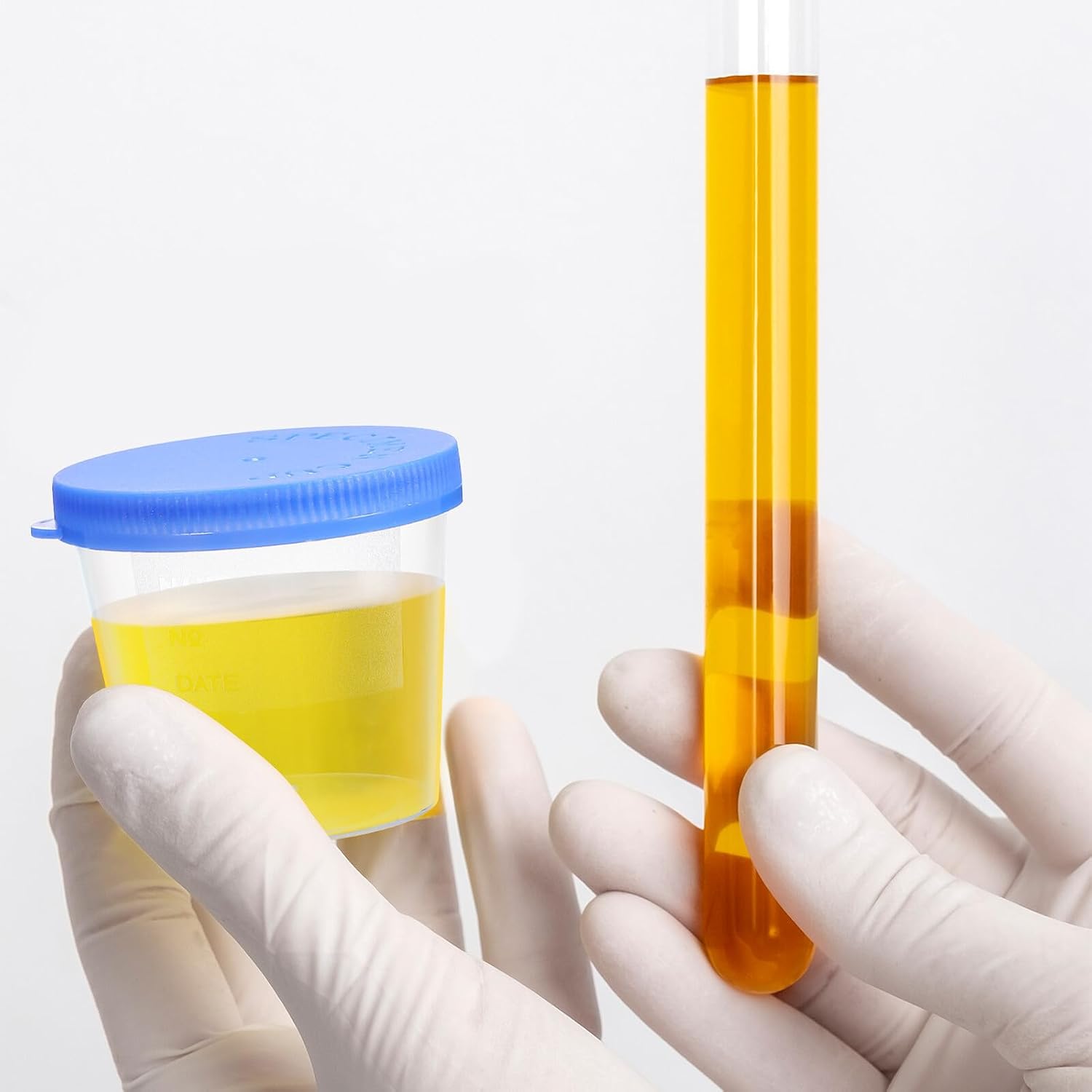 30pcs Disposable Plastic Sputum Collection Cups 40ml with Lid Containers for Hospital and Laboratory Use