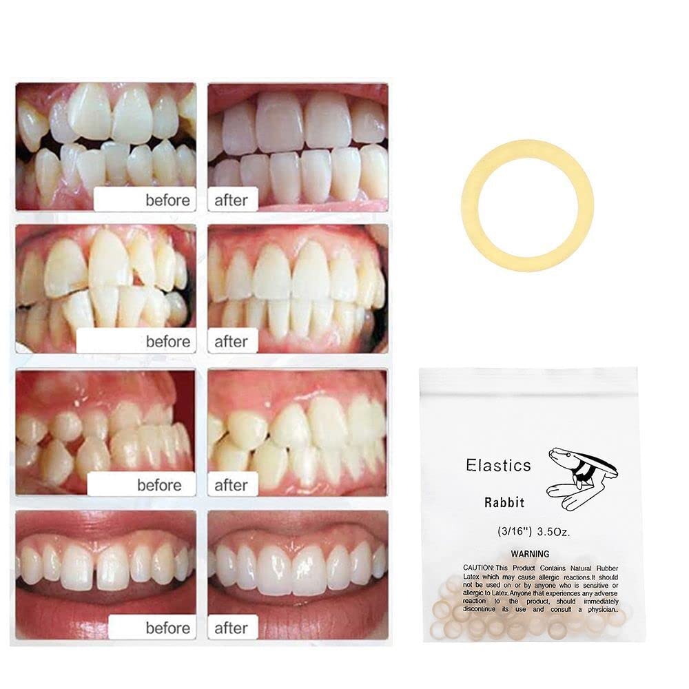 Buy Medical Grade Dental Rubber Bands Rubber Latex Rings Elastics