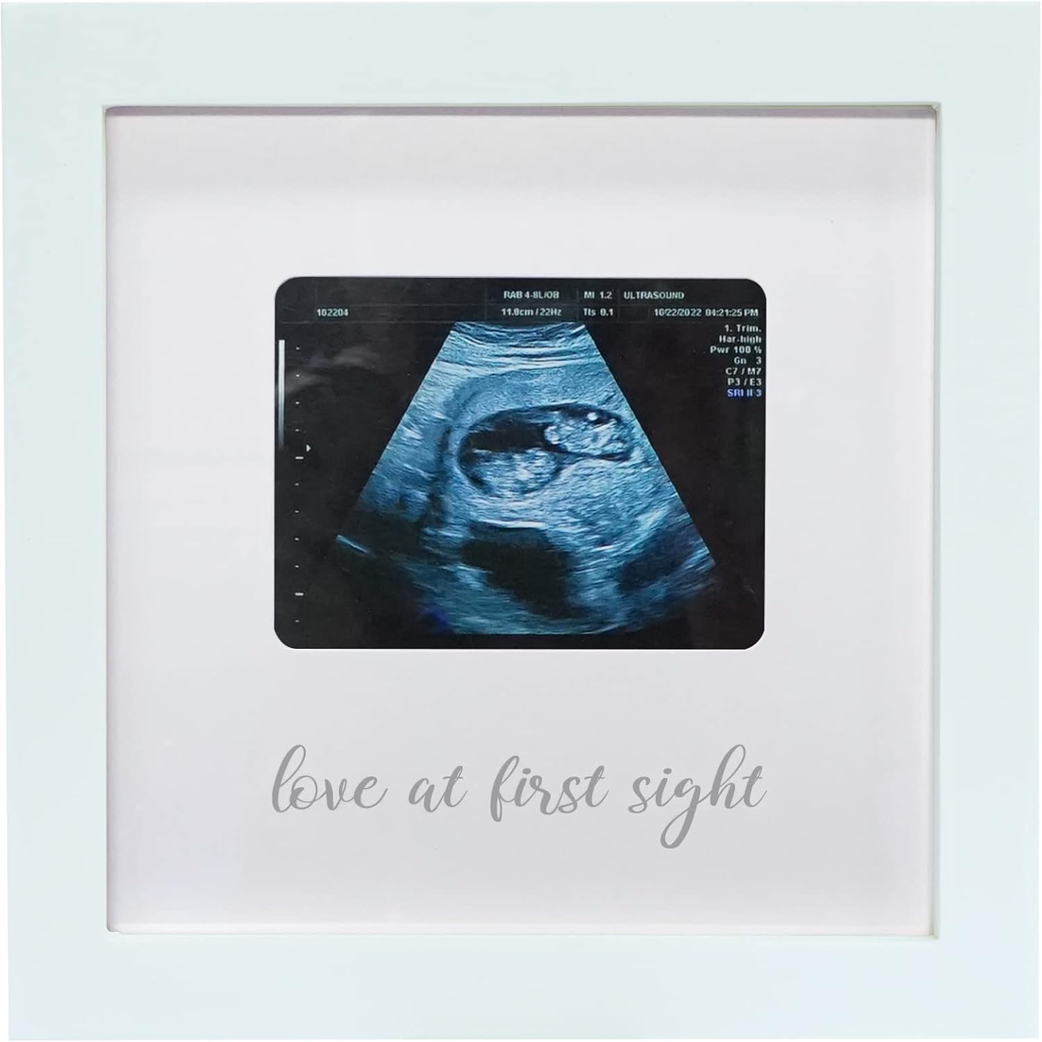 HAMUIERS Love at First Sight Ultrasound Picture Frames, Sonogram