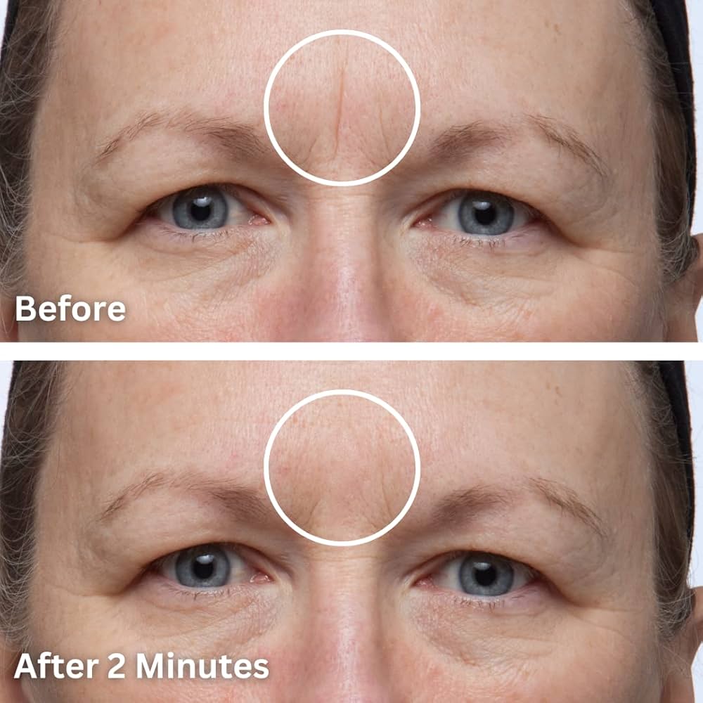 dermaflage ダーマフラージ Dermaflage Scar Concealer, 4 Pack