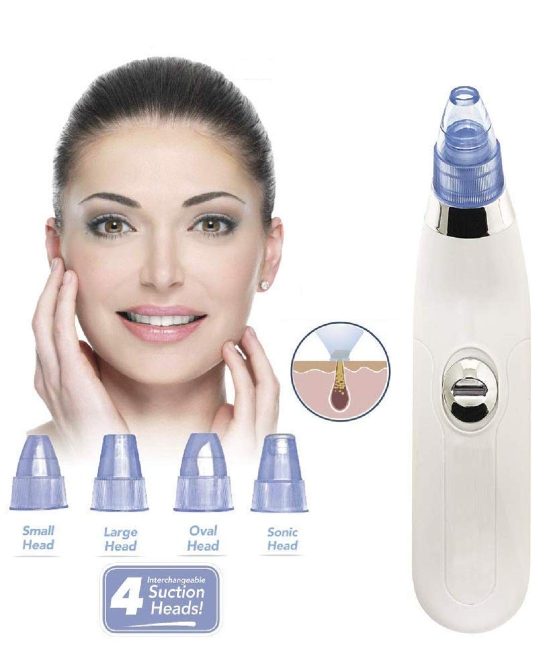 Surat Dream Blackhead Remover Pore Vacuum - Microdermabrasion Machine Black Head Cleaning Tool Pimple Sucker & Facial Cleanser Device for Pores Acne Nose Skin (White) 1
