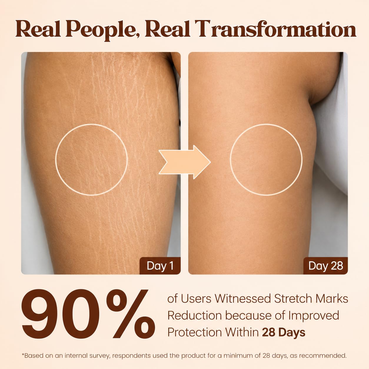 Pokonut Stretch Marks Cream for Women & Men | For Pregnancy, After Delivery & Weight Loss | Fades Old & New Marks on Belly, Thighs & Hips | Hyaluronic Acid + Rosehip Oil | Non-Sticky | 50g 1
