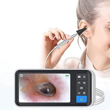 Digital Otoscope, Ear Canal and Nasal Examination Endoscope, 3.9mm Lens, 4.5 Inch Screen, with 6 LED Lights, Suitable for Adults, Children and Pets