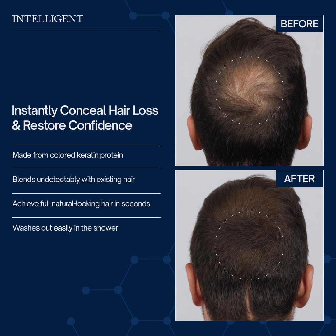 Intelligent Precision Hair-Volumizing Fibers (Light Blonde) | Undetectably Fill in Thinning Hair | 6 Shades Designed For Men or Women | 27.5g