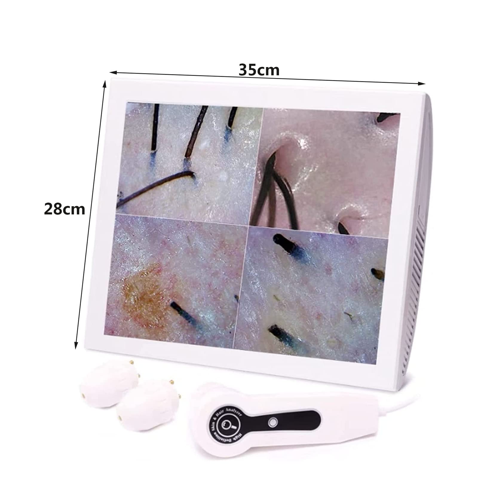 50X/200X Analizador de Cabello para diagnóstico de Piel, Pantalla LCD de 15 Pulgadas Máquina analizadora de Piel para diagnóstico de Piel Digital Operación Simple