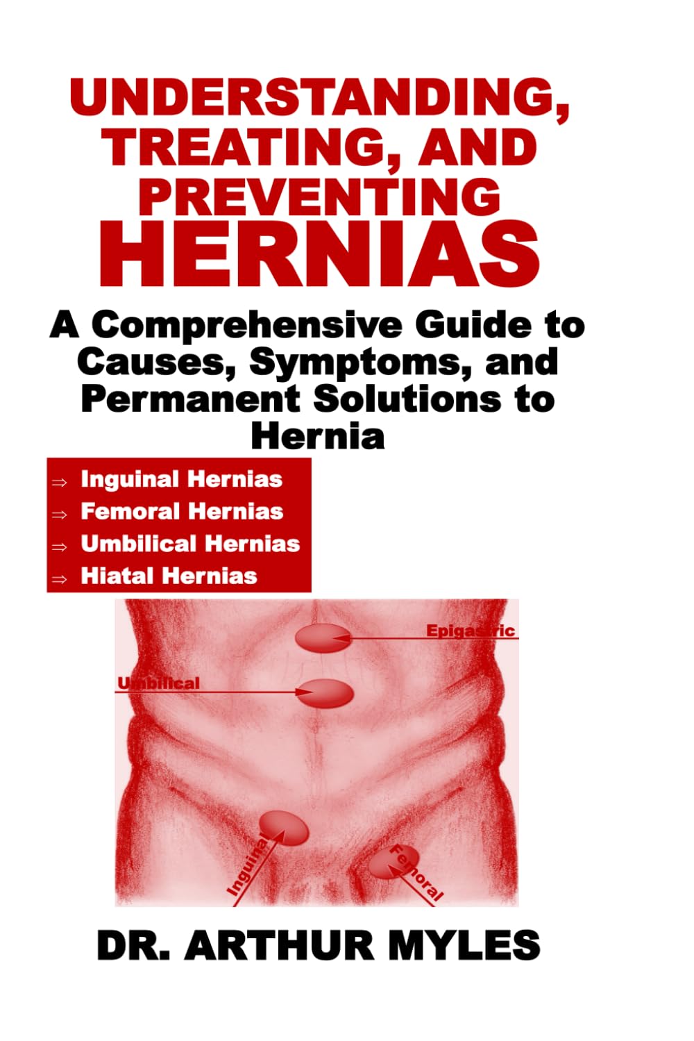 UNDERSTANDING, TREATING, AND PREVENTING HERNIAS: A Comprehensive Guide to Causes, Symptoms, and Permanent Solutions to Hernia