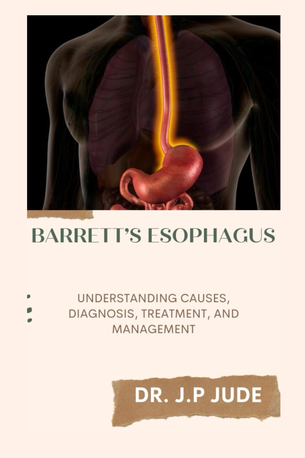 BARRETT’S ESOPHAGUS: UNDERSTANDING CAUSES, DIAGNOSIS, TREATMENT, AND MANAGEMENT