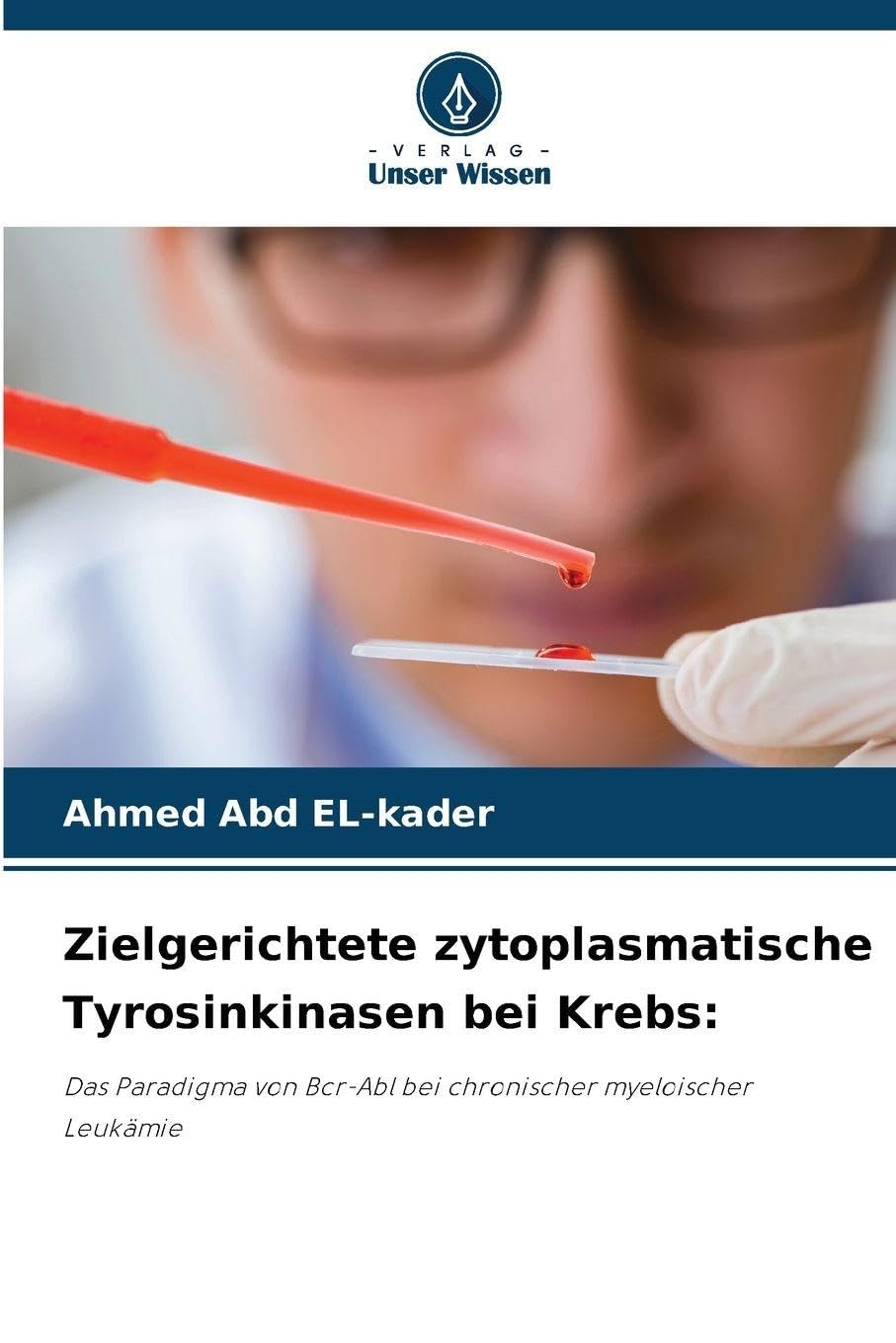 Zielgerichtete zytoplasmatische Tyrosinkinasen bei Krebs: Das Paradigma von Bcr-Abl bei chronischer myeloischer Leukämie