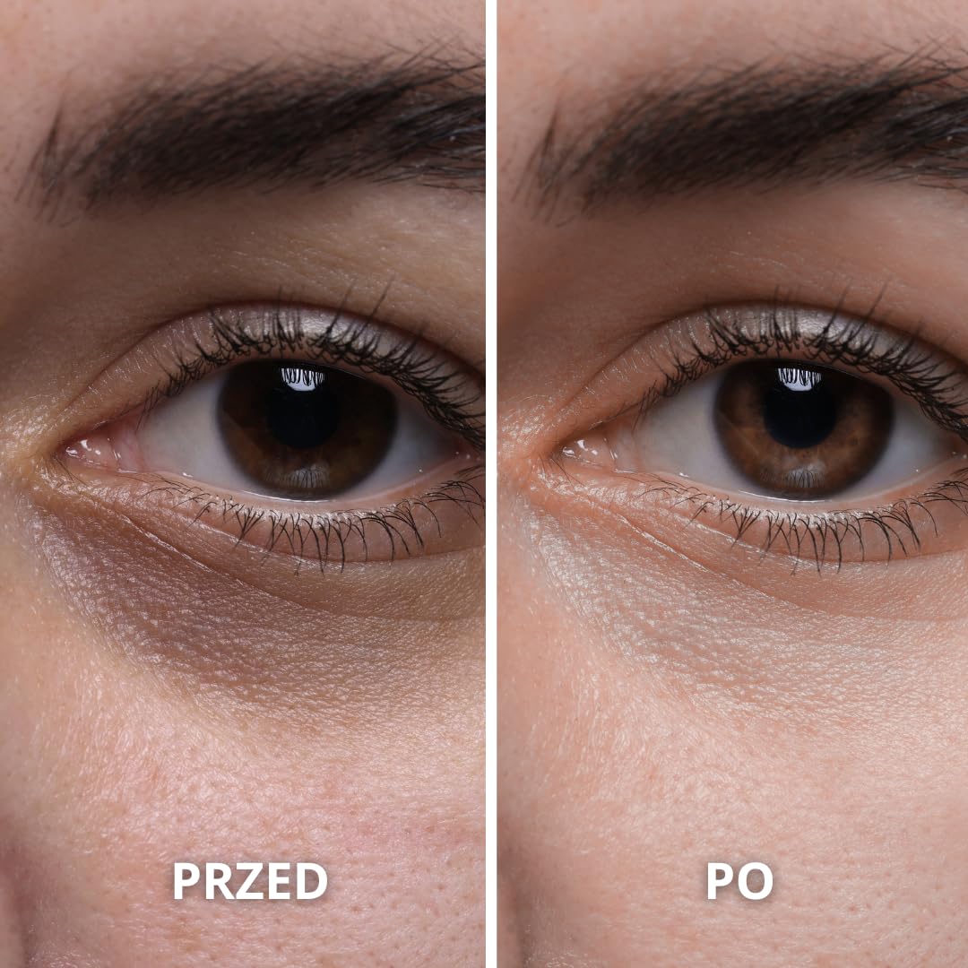 BEST LEPSZY OLEJK PRZECIWSTRZEŻOWY - 100% organiczny olej z figi z brązu, czysty i naturalny, tłoczony na zimno, wyjątkowo zy - Odżywcza pielęgnacja skóry, twarzy, włosów. Wegańskie (Figa 50ml)