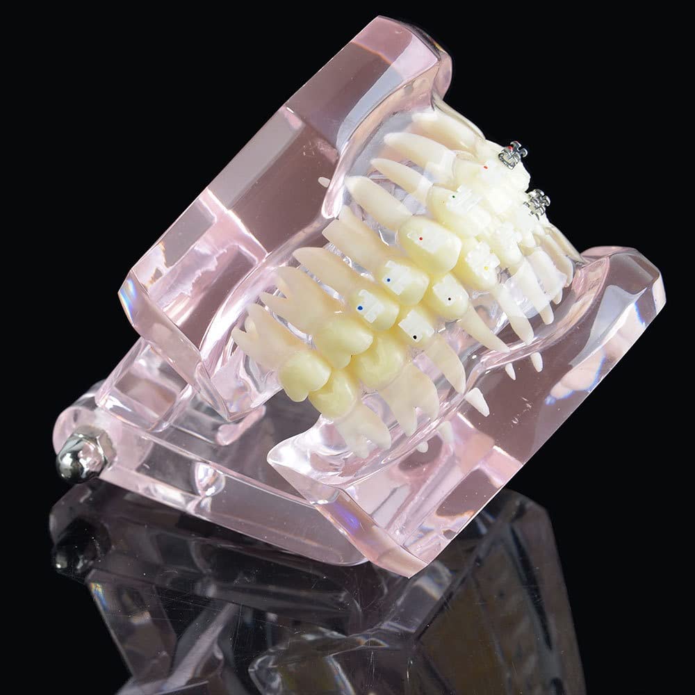 Modello ortodontico Dentale, Modello Standard ortodontico Dentale per Adulti con dimostrazione, per Strumento didattico per Lo Studio odontoiatrico della Scienza Me