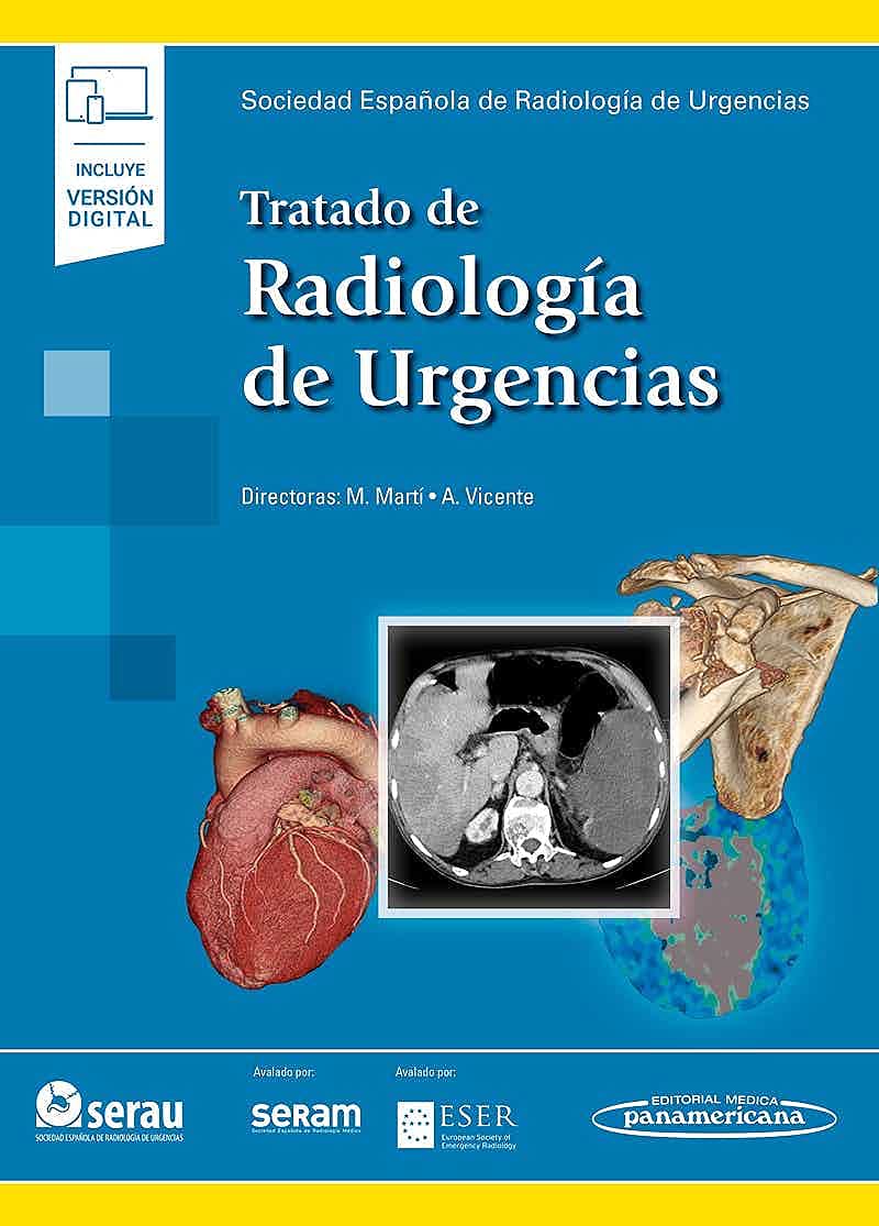 Tratado de Radiología de Urgencias (+ ebook)