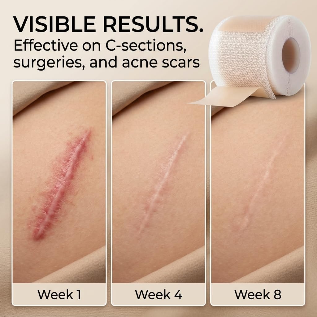 Silicone Scar Tape,Breathable & Skin-Friendly,1.6" x 10ft