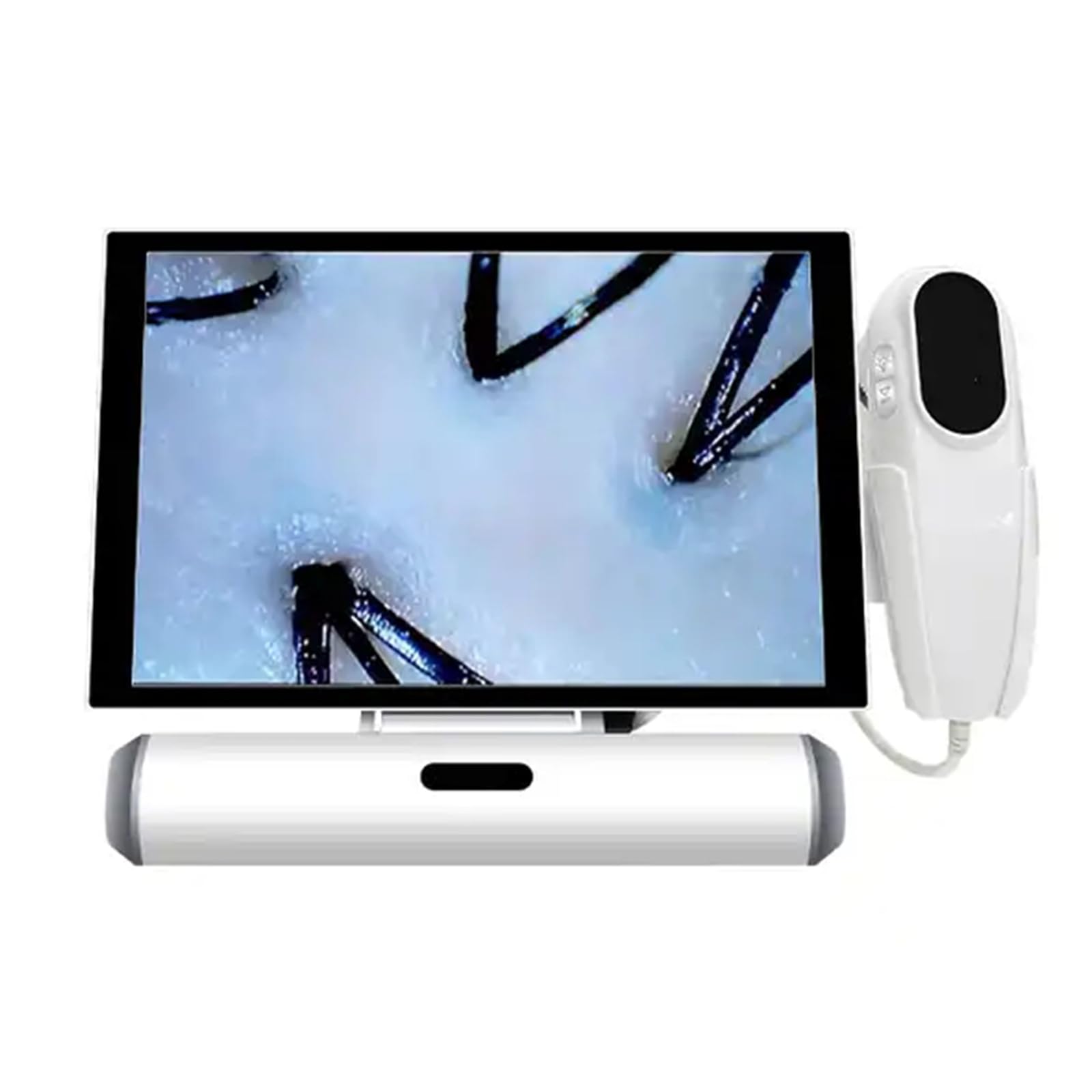 Portable 11 Inch Skin Diagnosis Hair Analyzer/Skin and Hair Analyzer Machine/Scalp Hair Follicle Detector with 4 Spectral Detection, 50/200 Times Magnification