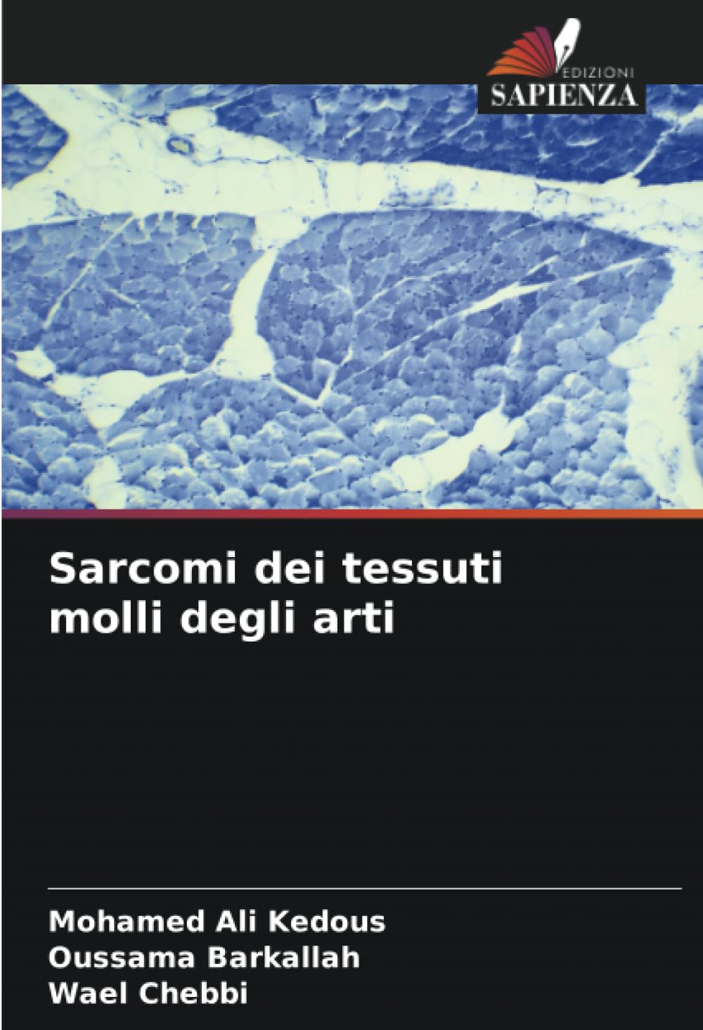 Sarcomi dei tessuti molli degli arti