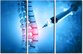 Severe Pain in the Spine and Intervertebral Discs Pictures Artwork Wall Decor 3 Piece Lumbar Spine Injection Pictures for Modern Hospital Decor Posters & Prints Framed Ready to Hang 42" Wx28 H