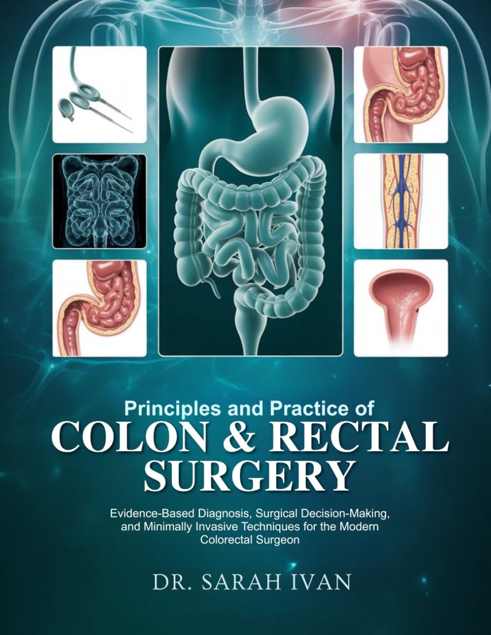 PRINCIPLES AND PRACTICE OF COLON & RECTAL SURGERY: Evidence-Based Diagnosis, Surgical Decision-Making, and Minimally Invasive Techniques for the Modern Colorectal Surgeon