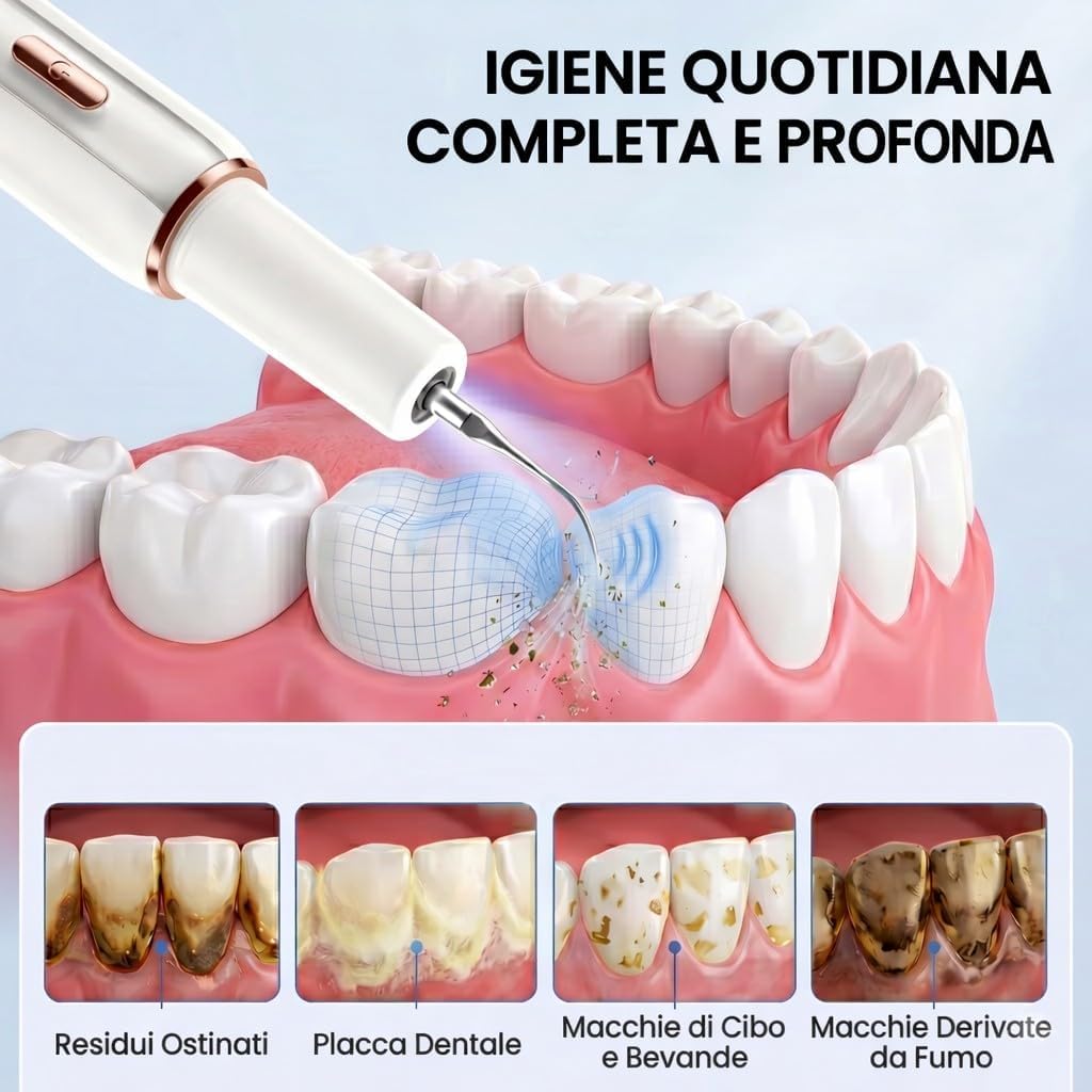 2.0 Kit Pulizia Denti Tartaro,rimuove La Placca E Le Macchie Dai Denti, Ideale Da Portare in Viaggio O A Casa
