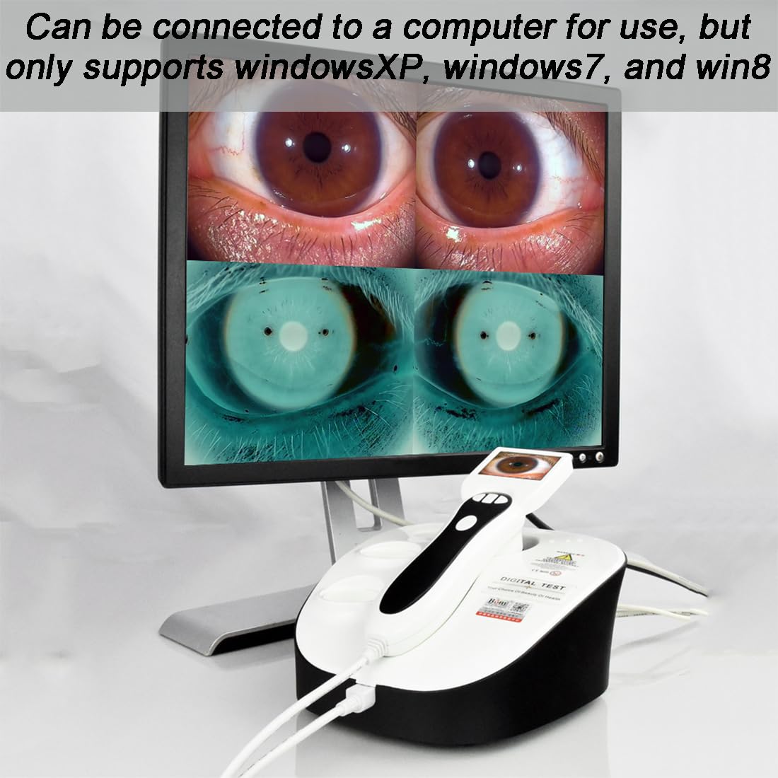 TsoLay Cámara De Iridología, Iridoscopio con Monitor LCD, Lente De Iris 30x/2,0 M Píxeles/analizador De Lámpara USB Izquierda/Derecha, Función 3D, Adecuado para Belleza, Salón, Hospital, Centros De