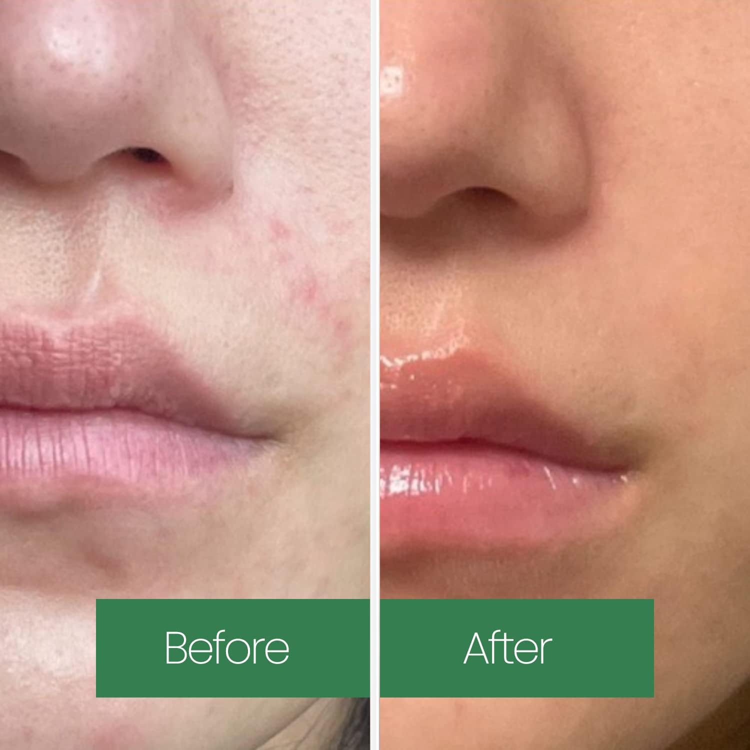 LAPALETTE Calming Green Turnover Toner | Green Tea | Hydrating & Moisturizing | Gentle Peeling with Natural Aha, Bha & PHA Ingredients | Red, Irritated Skin | Vegan | Korean Skincare 6.75fl.oz - Image 5