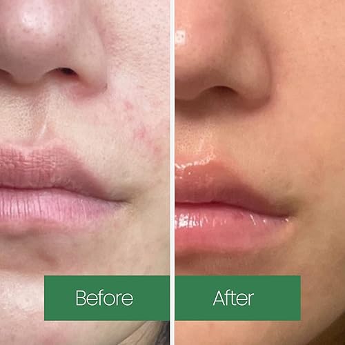 Miniatura 5 de Tónico calmante de rotación verde | Té verde | Hidratante e hidratante | Peeling suave con ingredientes naturales de Aha, Bha y PHA | Cuidado de la