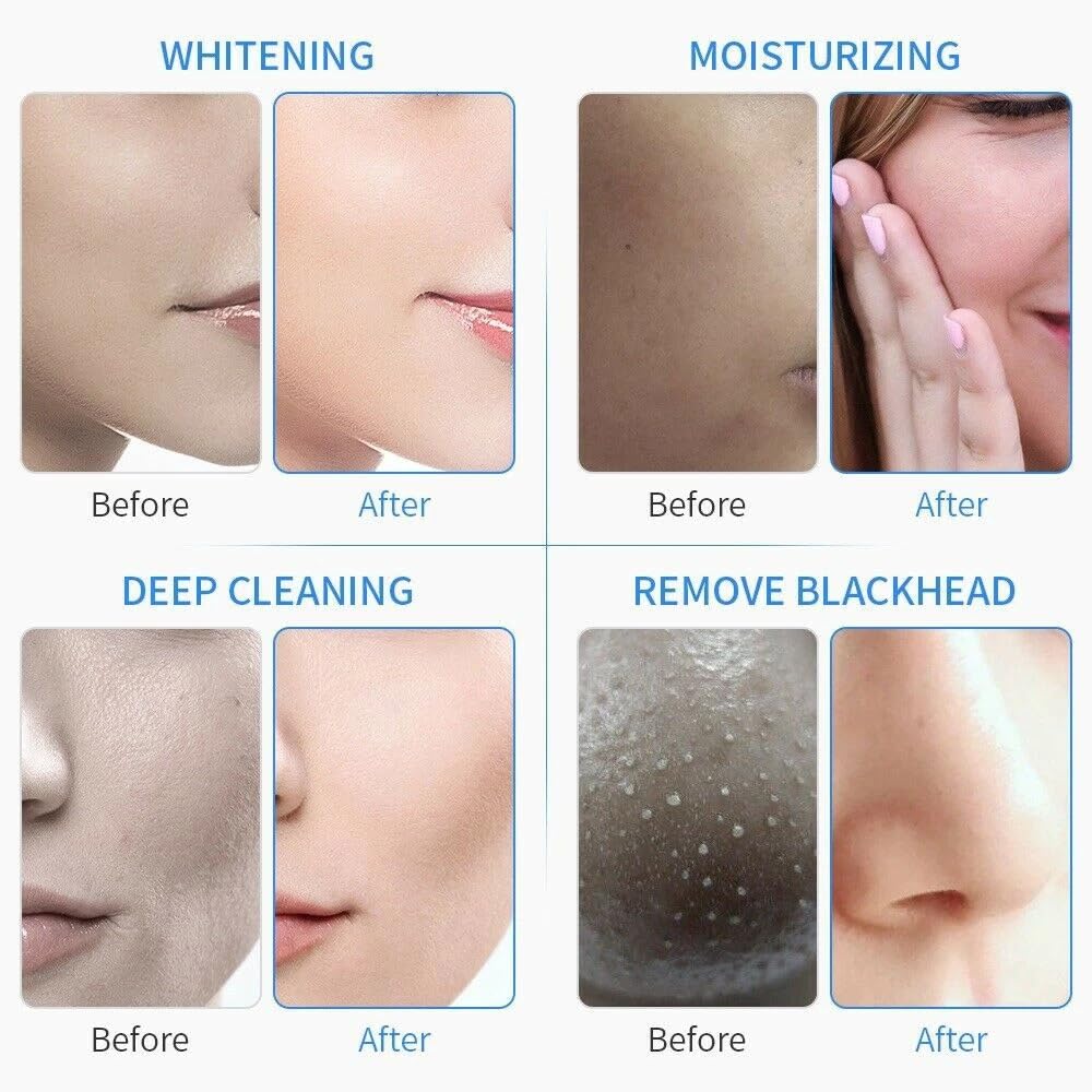 7 in macchina 1Multifunctional Hydrodermabrasion per la cura di pulizia della pelle
