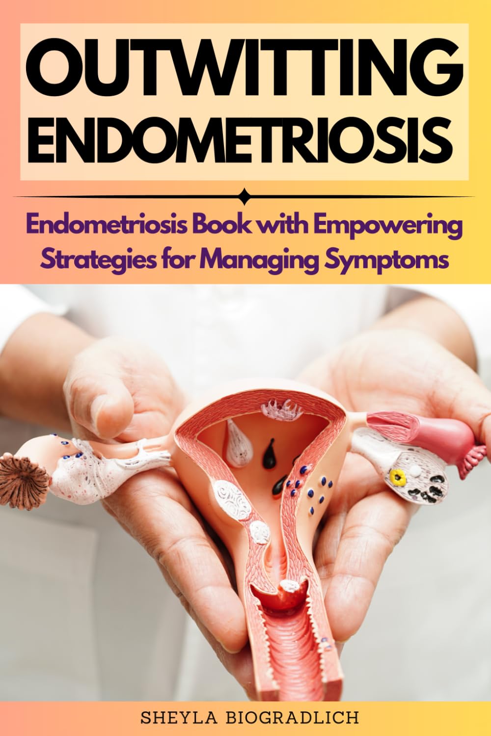 Outwitting Endometriosis: Endometriosis Book with Empowering Strategies for Managing Symptoms