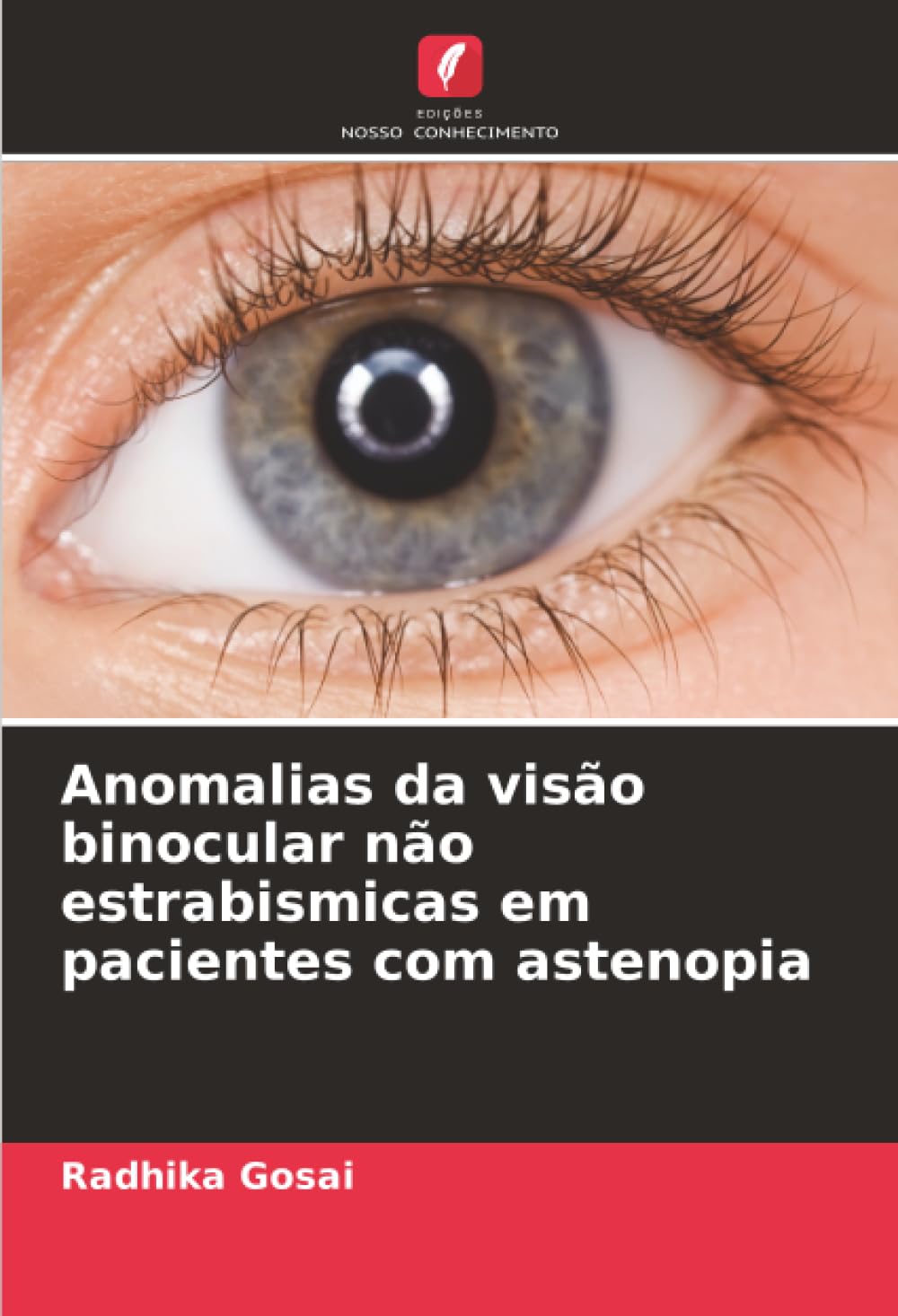 Anomalias da visão binocular não estrabismicas em pacientes com astenopia