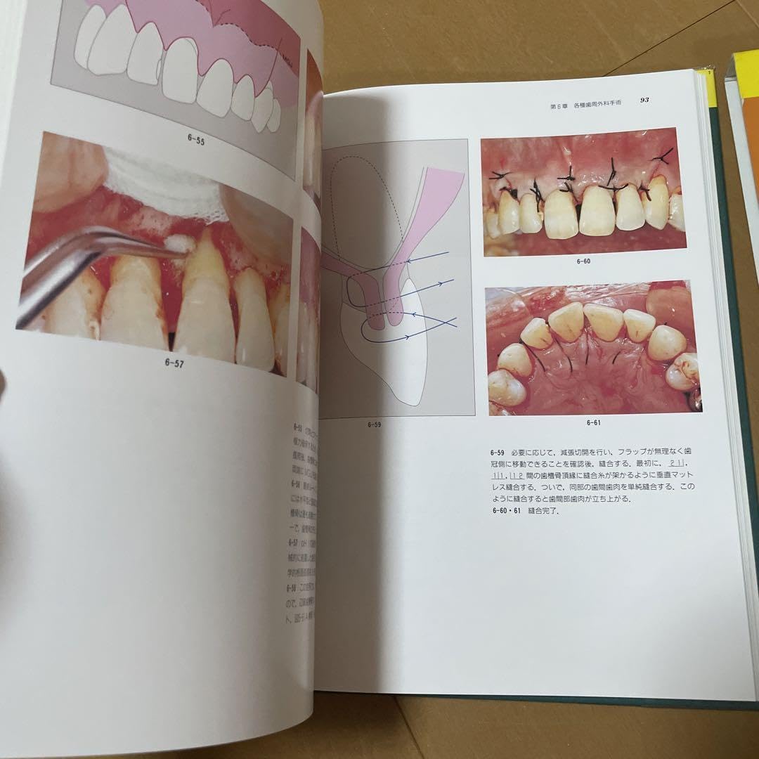 How to審美と歯周外科 How to審美と歯周外科 Amazon.co.jp: How to審美と歯周