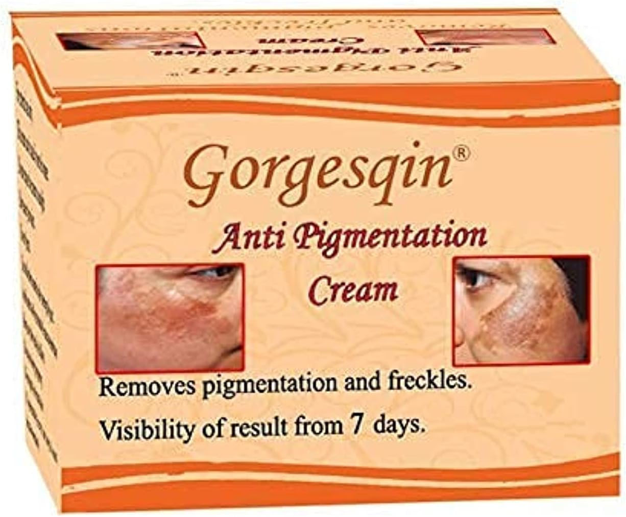 Anti Pigmentation Cream, Reduces & Removes Pigmentation From 7 Days, 6 G