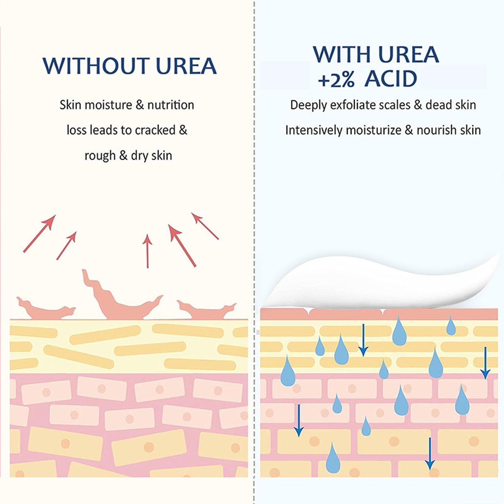 60% Urea Cream for Feet Cracked Heel Repair Cream for Feet and Hand Urea Foot Cream for Cracked Heels and Dry Skin - Image 4