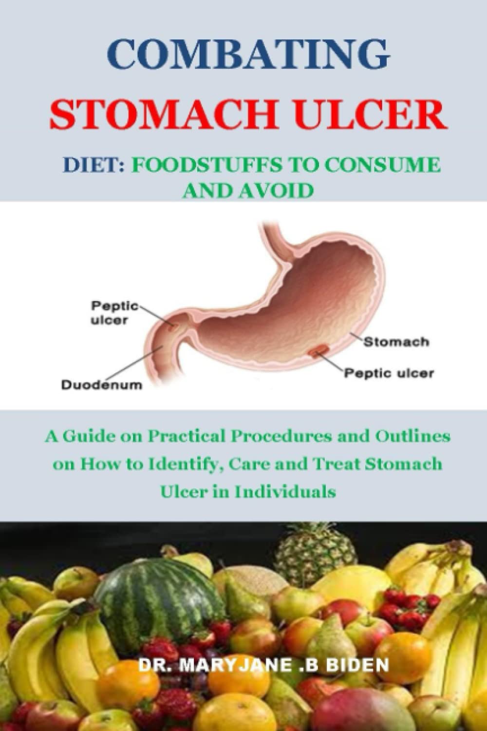 COMBATING STOMACH ULCER DIET FOODSTUFFS TO CONSUME AND AVOID A Guide on Practical Procedures