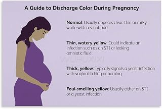 A Guide to Discharge Color During Pregnancy Poster (Maternity Hospital Decoration) Canvas Painting Posters And Prints Wall Art Pictures for Living Room Bedroom Decor 12x08inch(30x20cm) Unframe-style