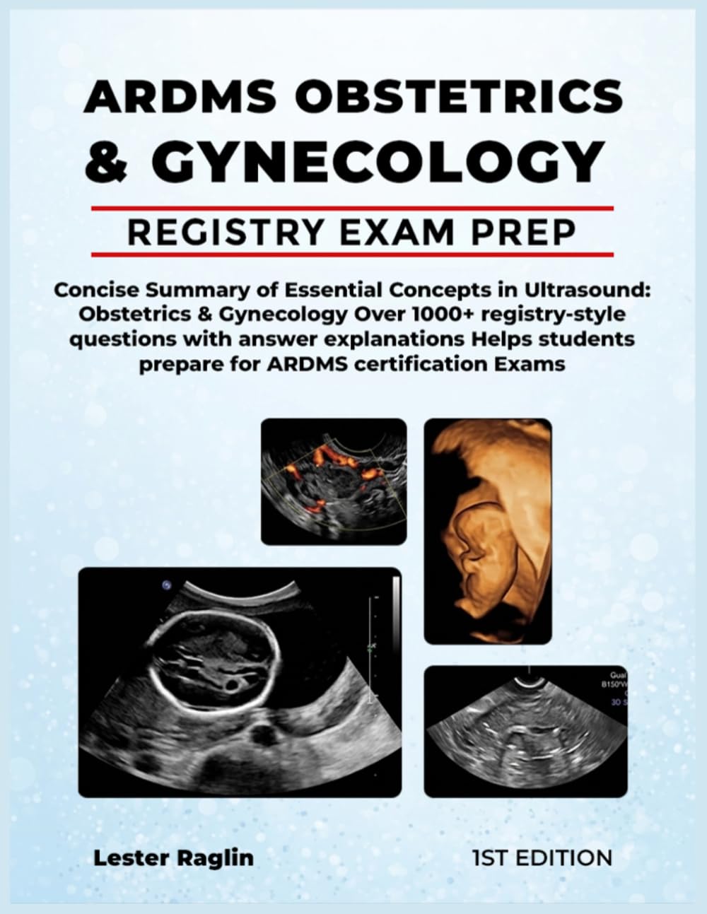 ARDMS OBSTETRICS & GYNECOLOGY: Concise Study Guide of Essential Concepts in Ultrasound & Obstetrics & Gynecology Sonography (Registry Review + Practice Questions)