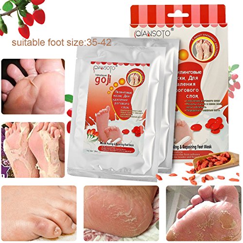 Foot Peel Mask - LuckyFine Wolfberry Repairing Feet Mask, Deep Exfoliation for Dry Dead Skin, Dry Skin Foot Treatment,Make Your Feet Irresistible (2 Pairs per Box)