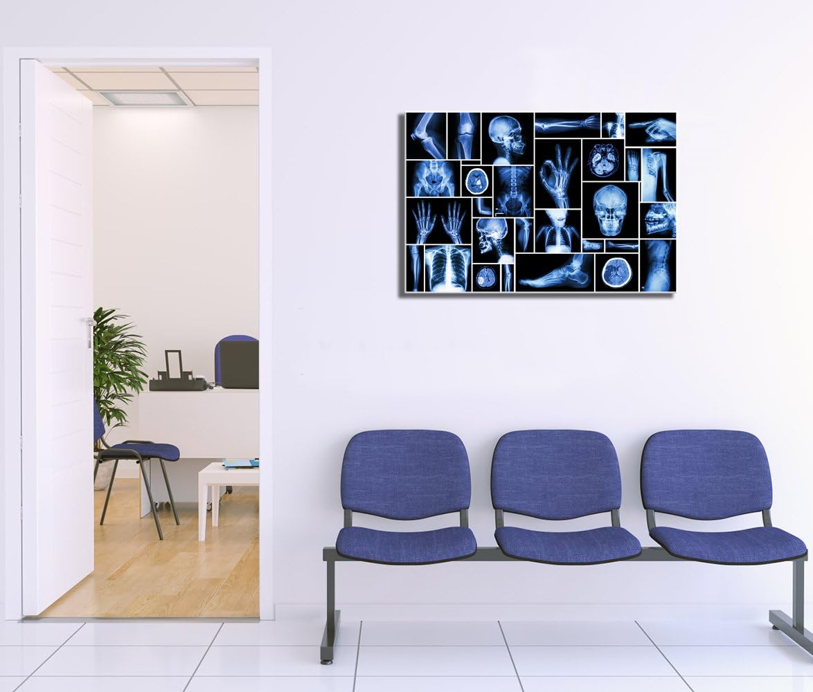 KLVOS Large Abstract Skull Canvas Art Wall Decor Black and Blue Collection Xray Multiple Part of Human Organs Gallery Wrap Canvas Prints Home Decor Giclee Print for Hospital Office Ready to Hang