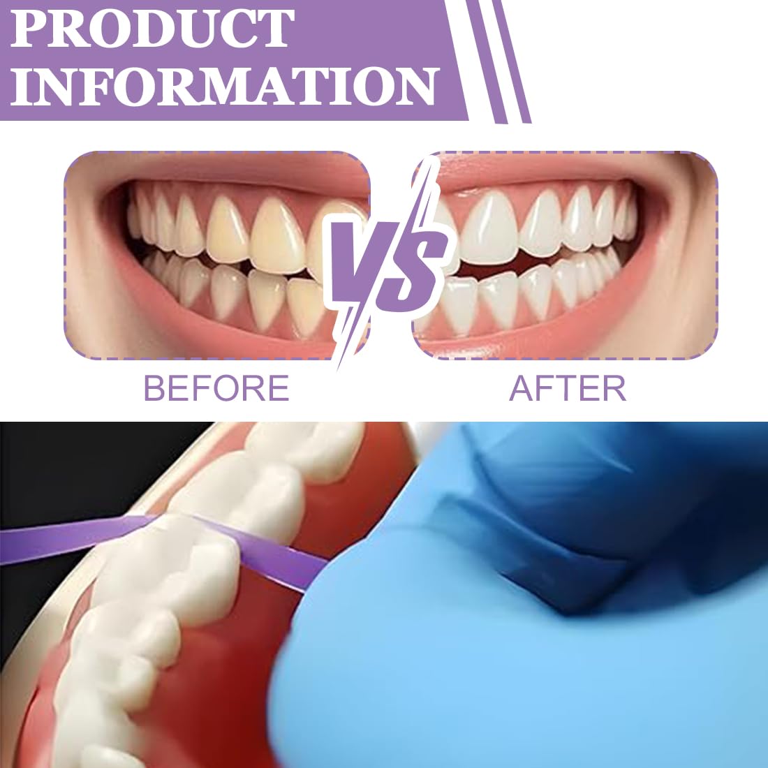 1 Roll 50 Μm Interdental Abrasive Strips Dental Box Polishing Strip Abrasive Paper For Teeth Whitening Strips Strisce Sbiancanti Denti For Sanding Cleaning Interdental Teeth 4 Mm X 6 M