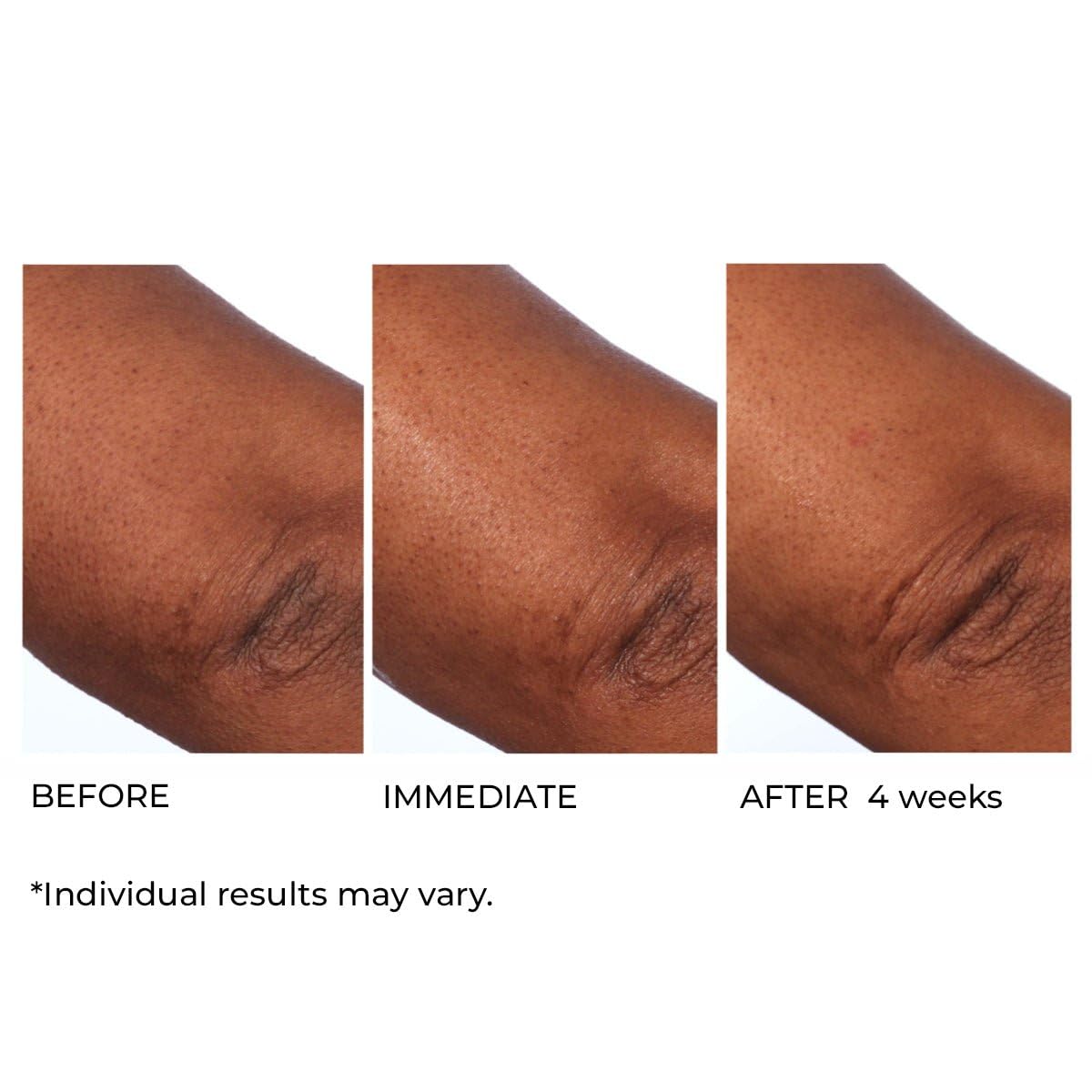 NassifMD Hydro-Screen Intense Hydration Face And Body Souffle