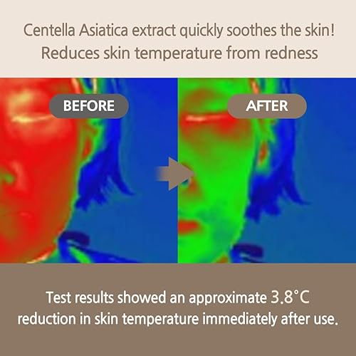 Miniatura 4 de Centella Suero calmante con leche de burro | 3.4 fl oz 3.38 onzas | Enfriamiento | Hidratante | Calmante | Hipoalergénico | Esenciales de verano |