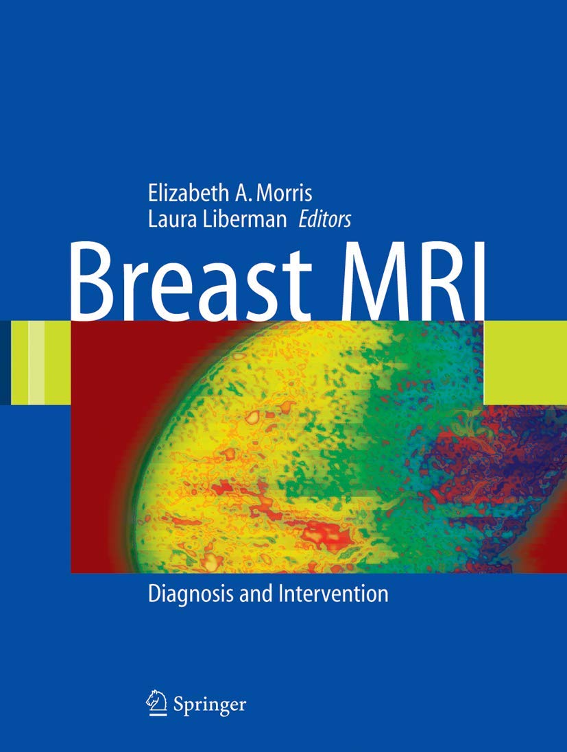 Diagnostic Breast Imaging 第2版 Diagnostic Breast Imaging: Mammography, Sonography, MRI and