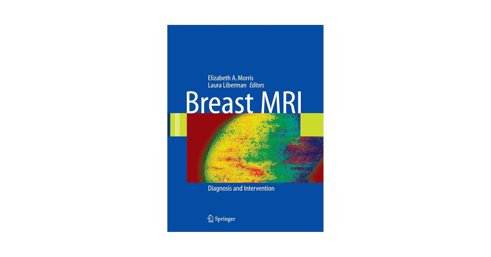 Breast MRI: Diagnosis and Intervention: 9780387219974: Medicine