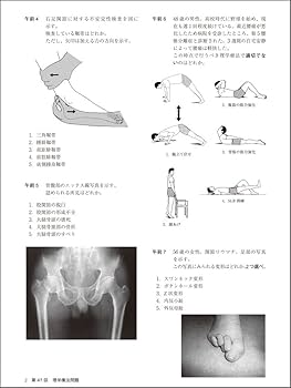TRYカコモン 理学療法士 第45回～第59回 国家試験専門問題 15年