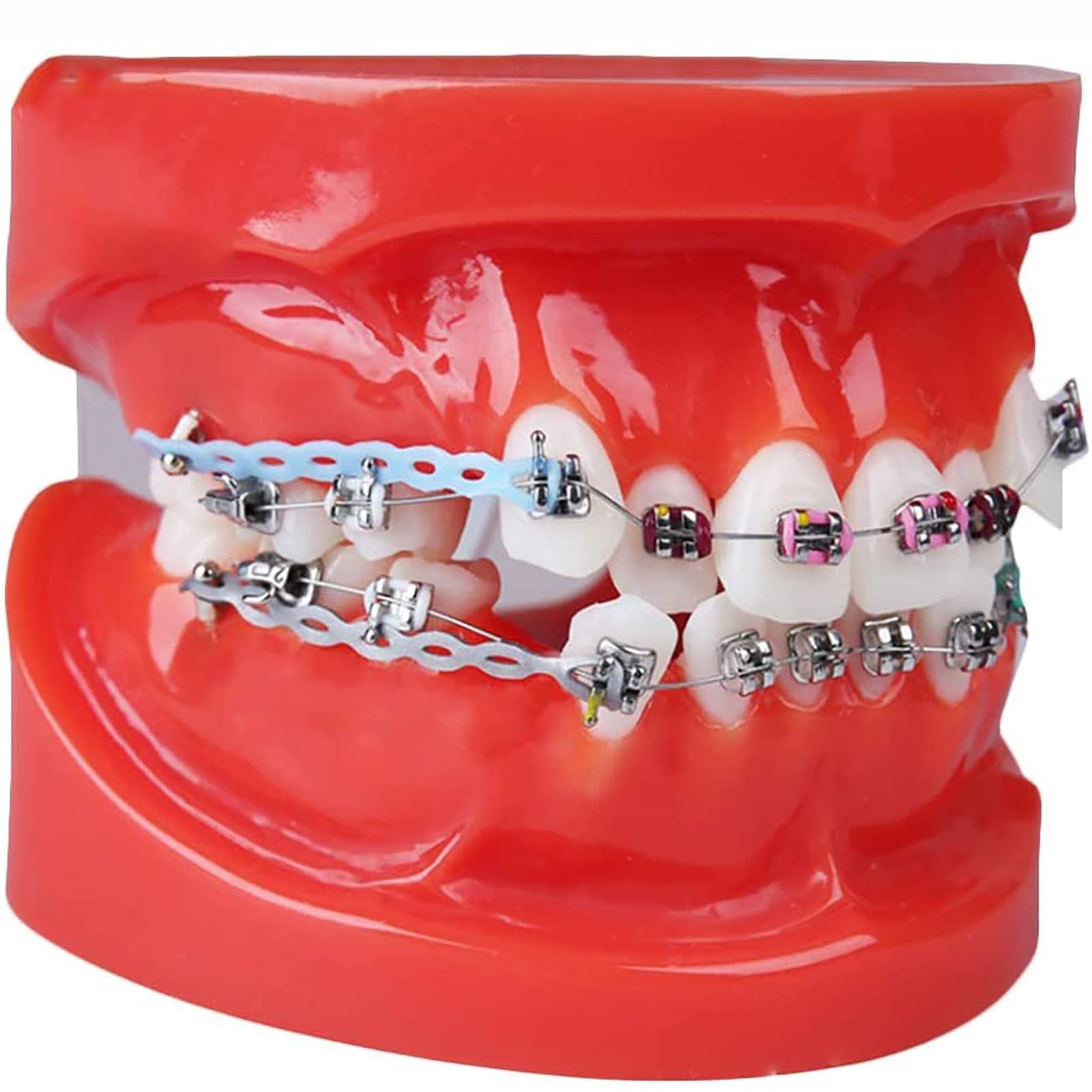 Dental Typodont Erwachsene Demonstration Zahnmodell mit mentalen Zähnen Kieferorthopädische Zahnspangen Modell mit Blattschraube Bänder, Rot