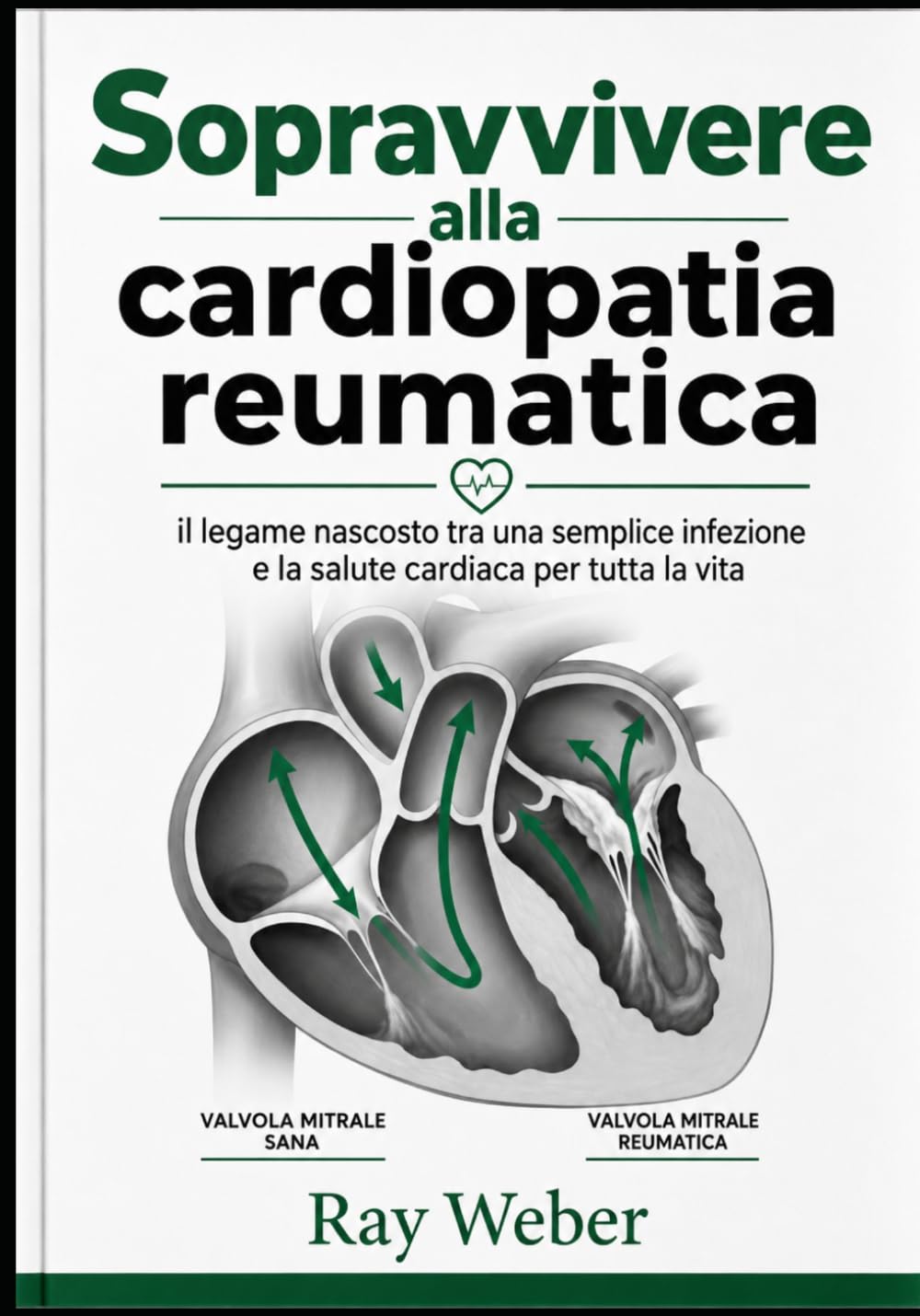 Sopravvivere alla cardiopatia reumatica: il legame nascosto tra una semplice infezione e la salute cardiaca per tutta la vita (Serie "Guida alla ... Proteggi il tuo cuore. Vivi più a lungo.)