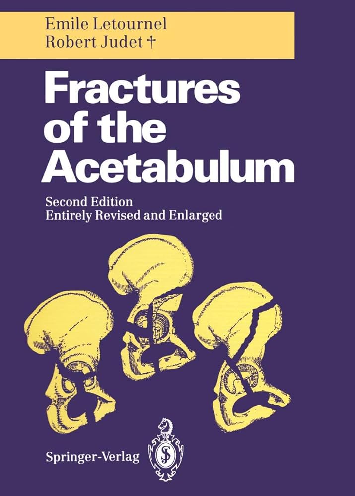 健康・医学 Fractures of the Acetabulum Fractures of the Acetabulum: 9783642754371: Medicine