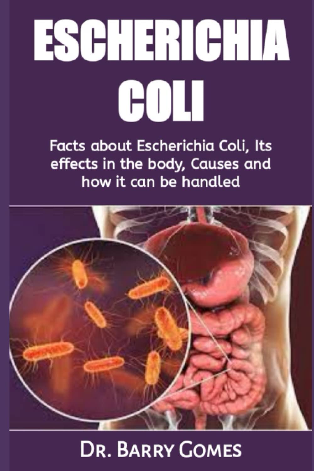 Buy ESCHERICHIA COLI Facts about Escherichia Coli, Its effects in the