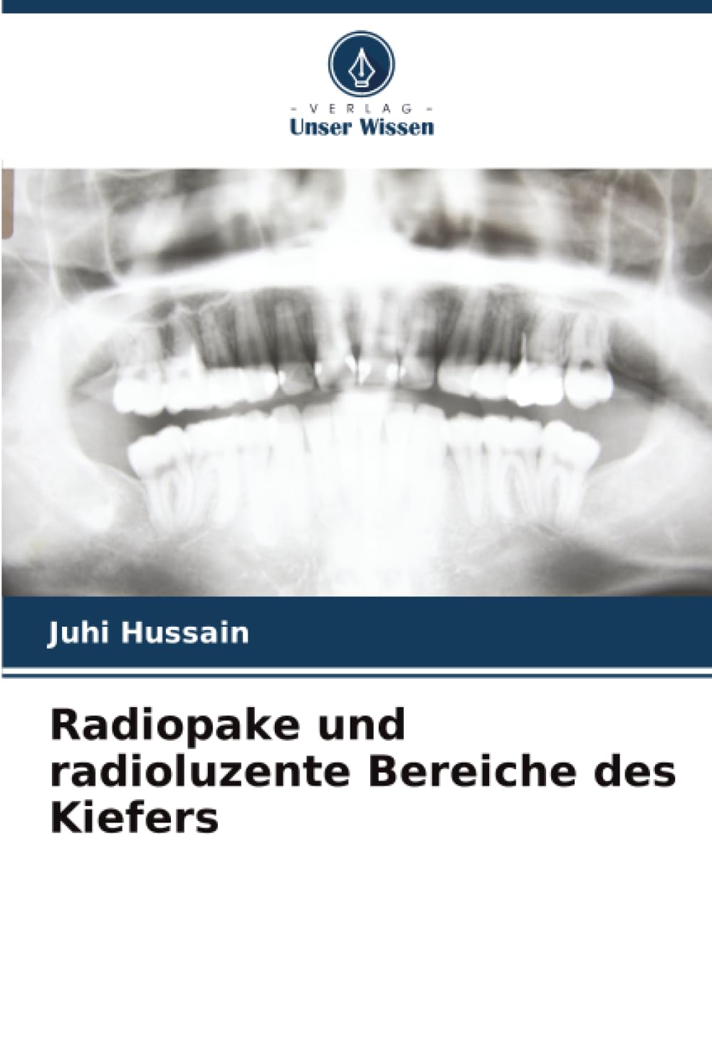 Radiopake und radioluzente Bereiche des Kiefers