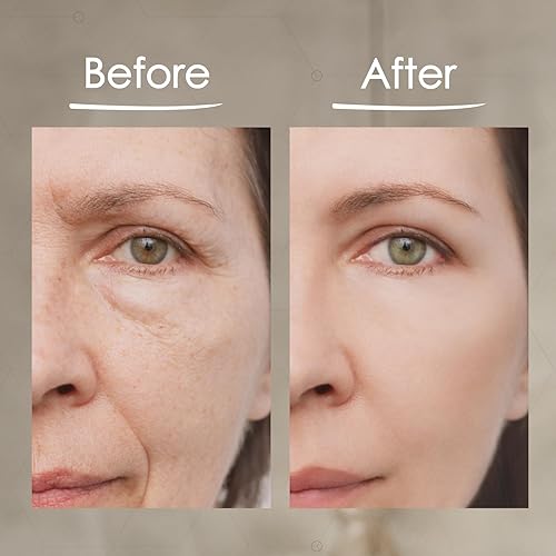 Miniatura 6 de MaxiLift - Suero de estiramiento facial instantáneo, suero para la piel para la cara y el levantamiento instantáneo de ojos, suave y firme piel