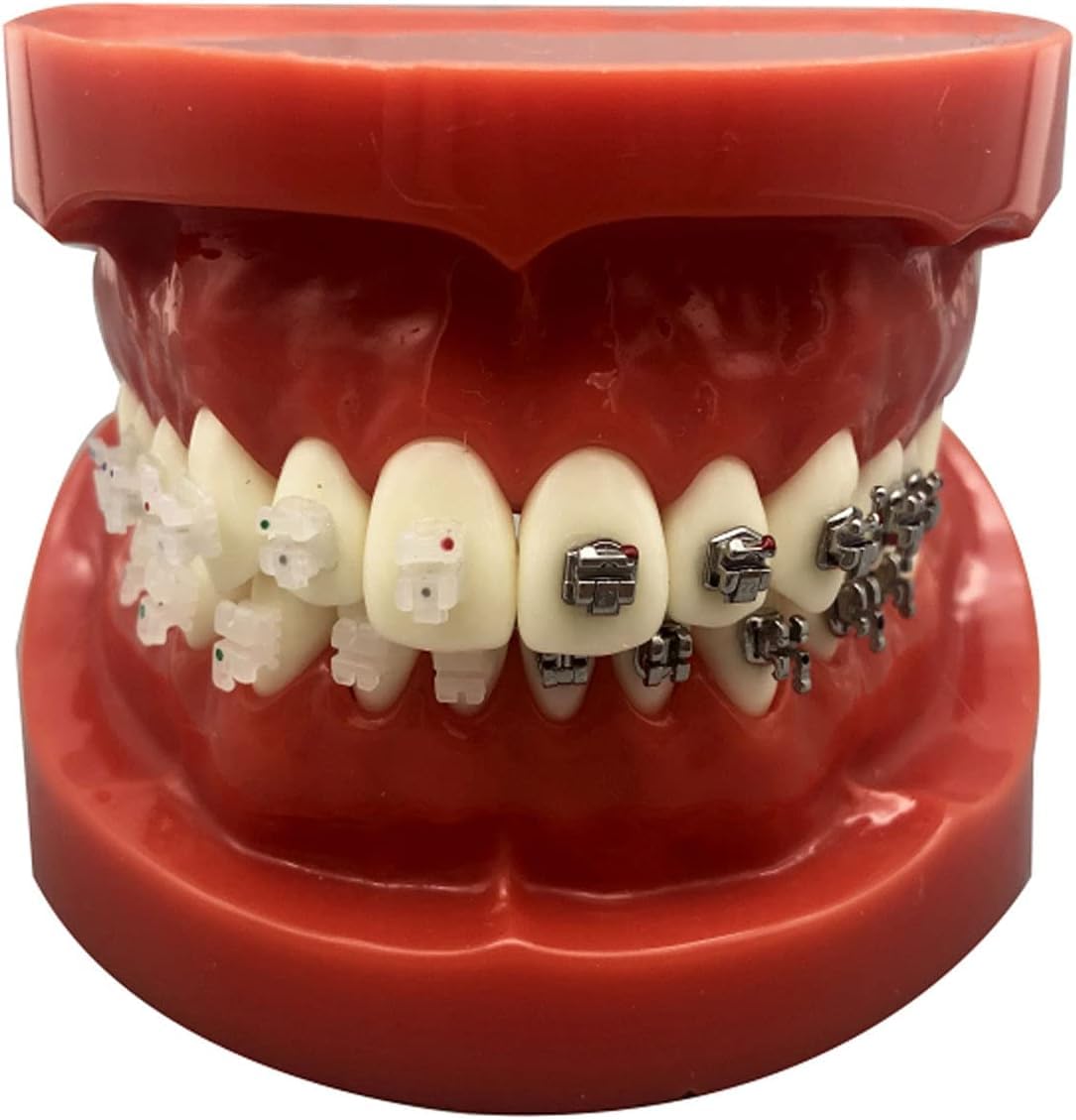 Model Dentystyczny Duplikat Formy, Model Ortodoncji, Model Dentystyczny Cztery Modele Porównawcze Zamków, Trwały Model Standardowy Badania Nauczania Dla Laboratorium
