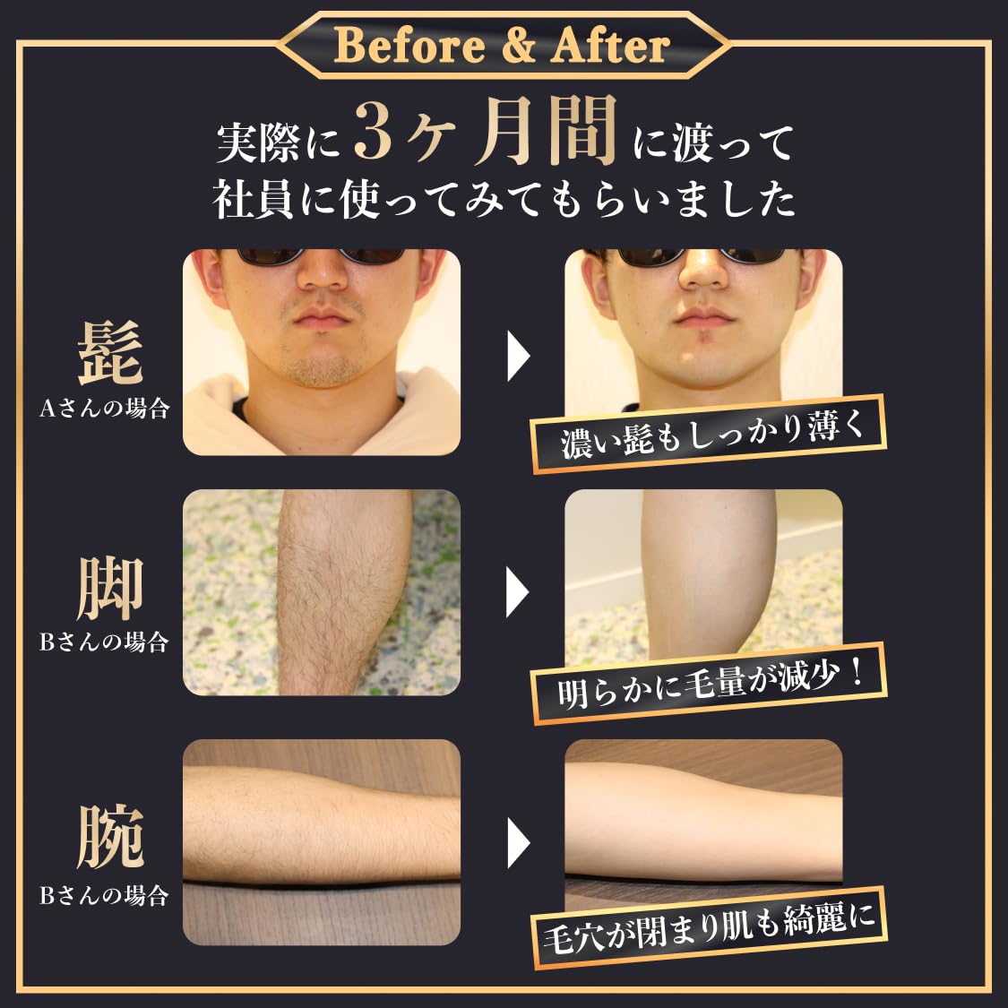 新品未開封】 CLEAR MAX 脱毛器 メンズ脱毛サロンNo.1*¹のノウハウを