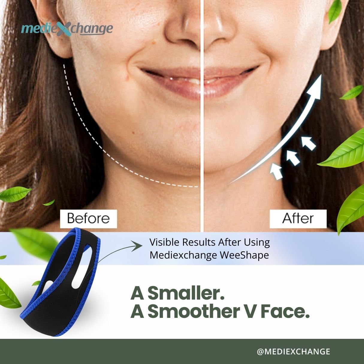 Mediexchange Weeshape Reusable Face Lifting Strap for Women & Men | Fabric Facial Contouring Band | Double Chin Reducer & V-Line Lifting Belt | Soft, Adjustable Face Shaping Strap (1 Pack) 2